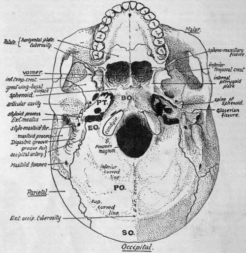 Carotid Foramen Skull